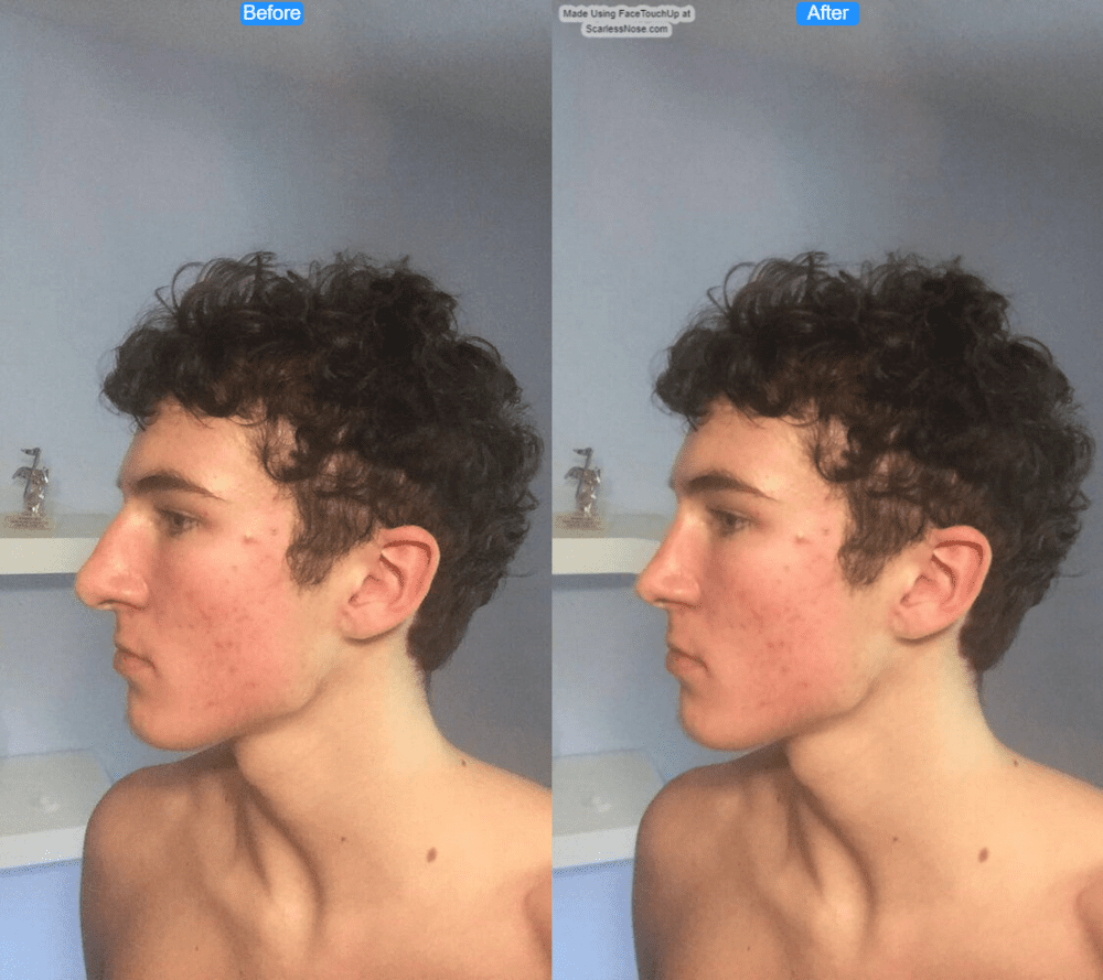 Idiot1 before after