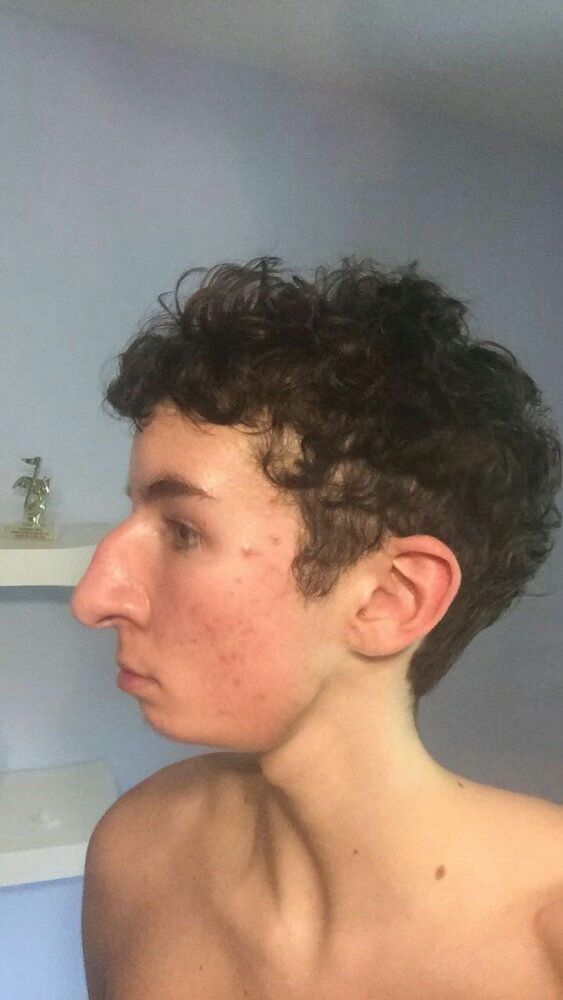 PSFix 20200303 144921