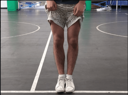 My legs