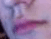 Philtrum human