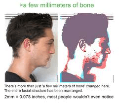 1583790785523 1583790785523
