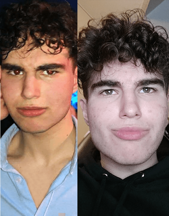Weightloss