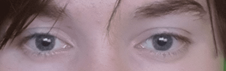 Disgusting Eye rate my disgusting eyes. Is there a way to improve eye area without ...