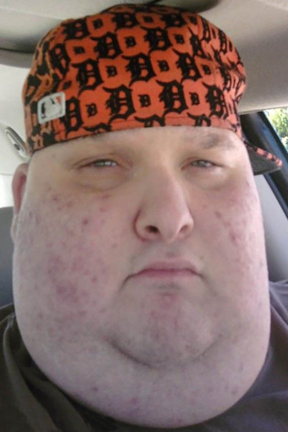Ugly fat guy