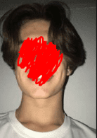 FACIAL STRUCTURE 2