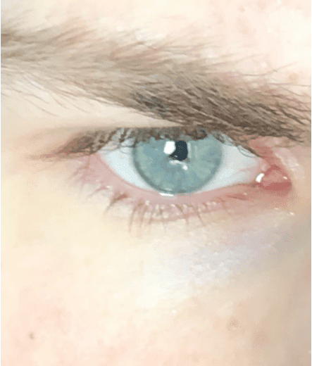 Eyecolor