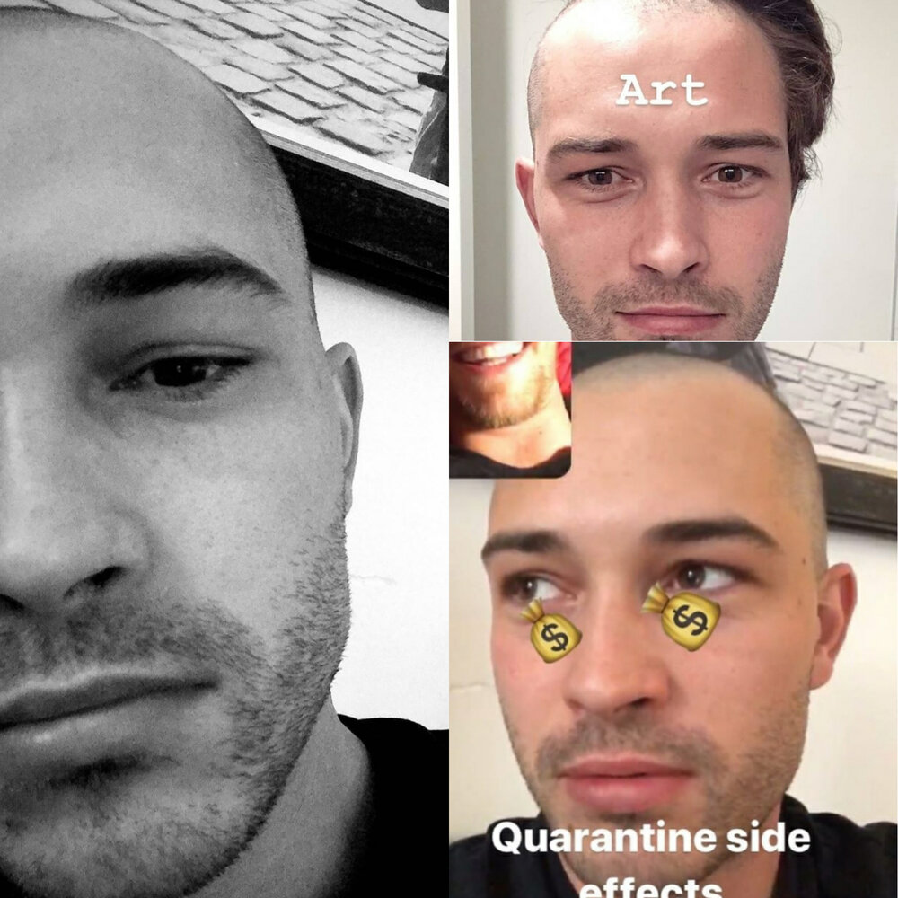 BaldChico1