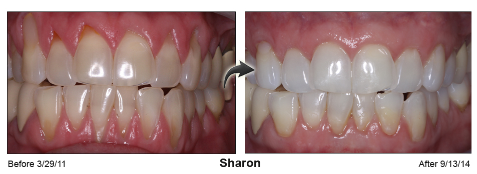 68138A51 FEEC 4320 ACD6 85C06D60974A