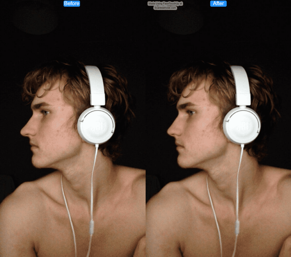 Morphs1 before after 2