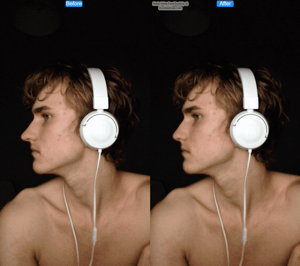 Adidus2 before after