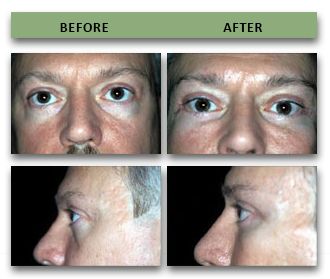 1347DEBA 171A 4A7D B0F4 4C4E2DFD61D4