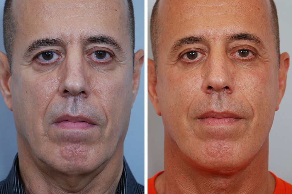 1F1B671B C230 472B B4DD 016CAE33BD01