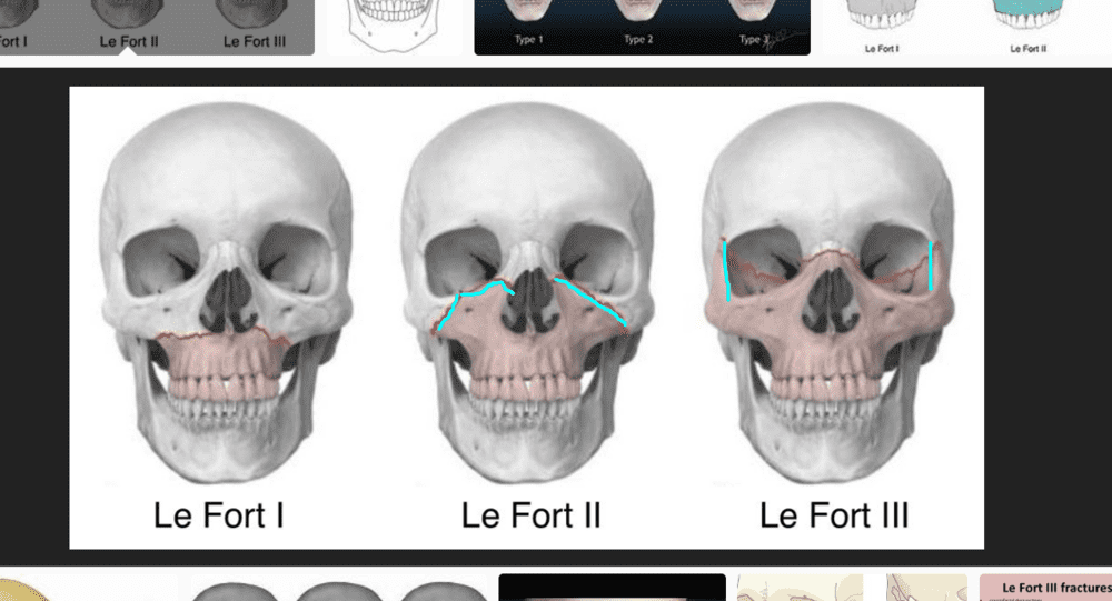1585358742075