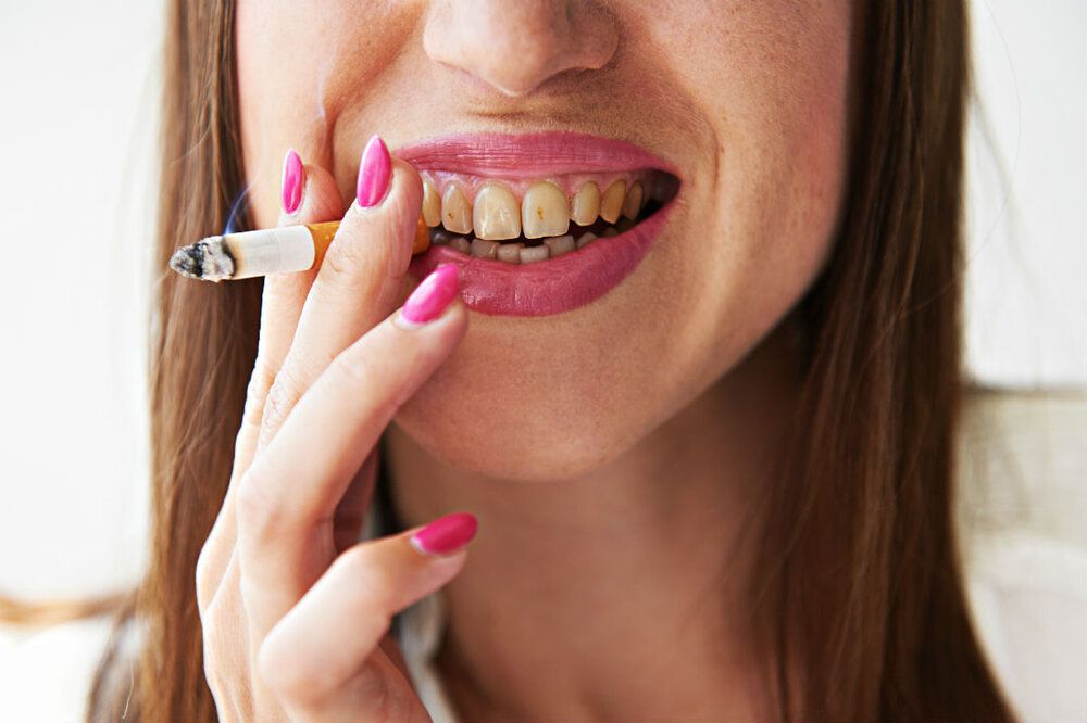 Smoker teeth 1