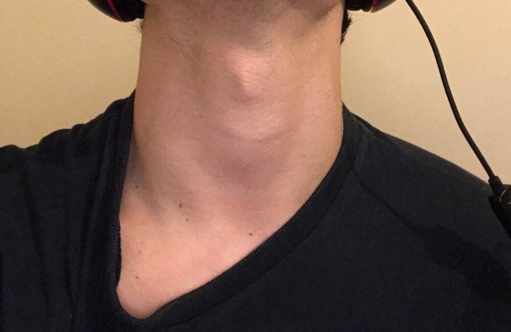Neck