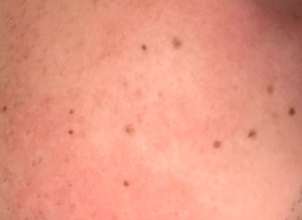 Dots