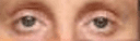 Eye are prey