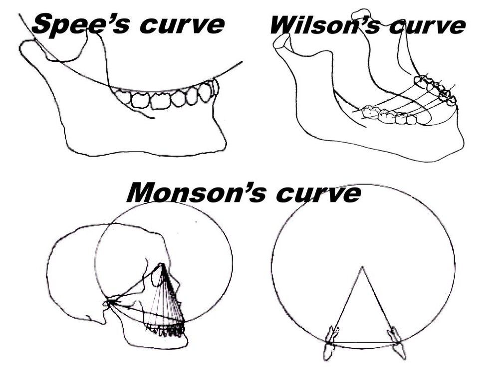 SpeescurveWilsonscurveMonsonscurve