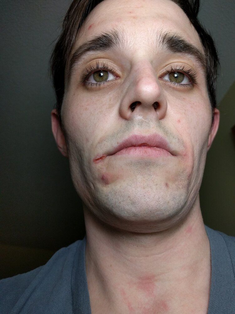 Baldcel1