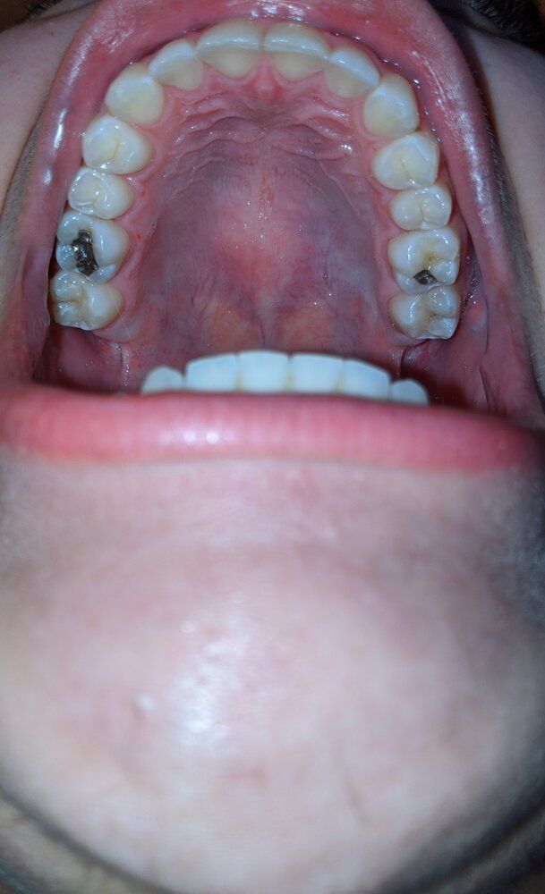 IMG 20200326 213031