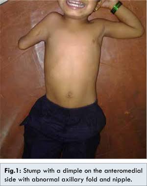 Images   2020 04 01T210108217