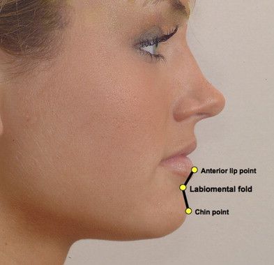 1 s20 S0094129807000764 gr24