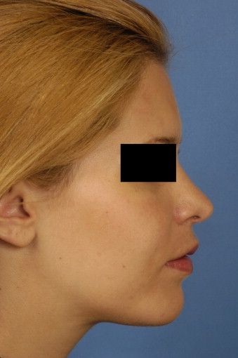 1 s20 S0901502709009564 gr5