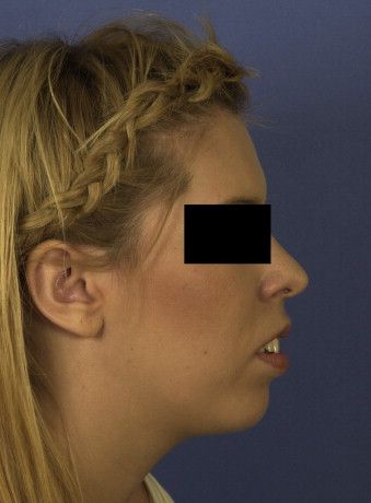 1 s20 S0901502709009564 gr3