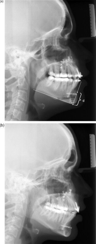 1 s20 S0901502709009564 gr6