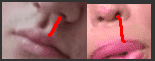 Philtrum x2 almost