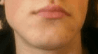 Wide lips
