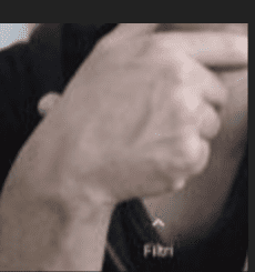 Wrist 1