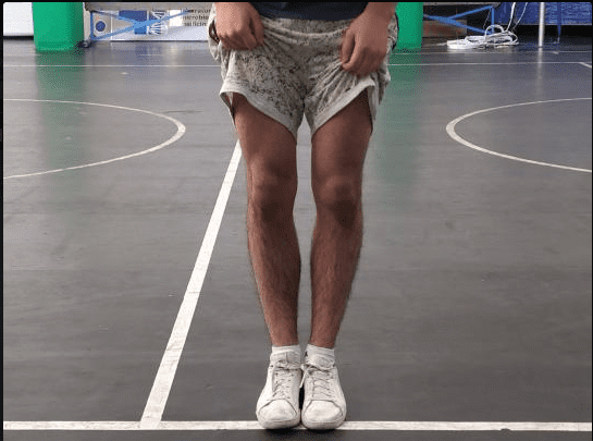 My legs