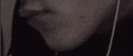 Advanced maxilla