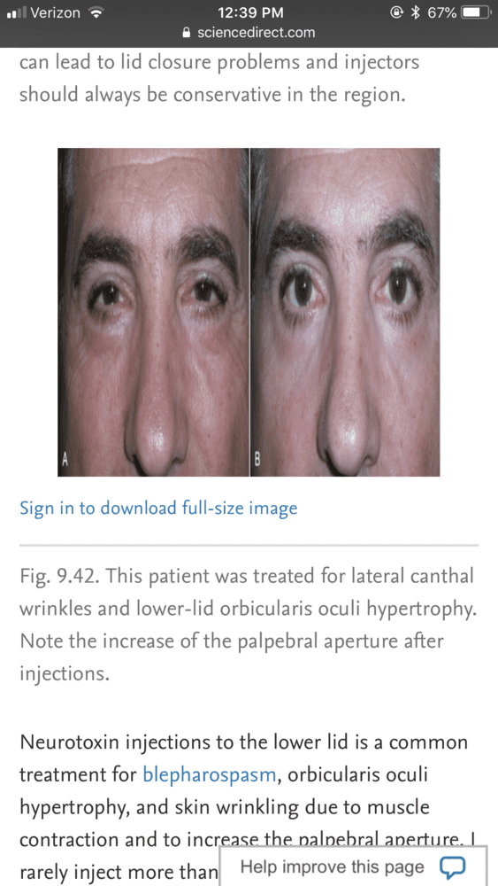 030B2366 AE03 47E4 B821 AF245D8B4060