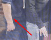 Wrist 2