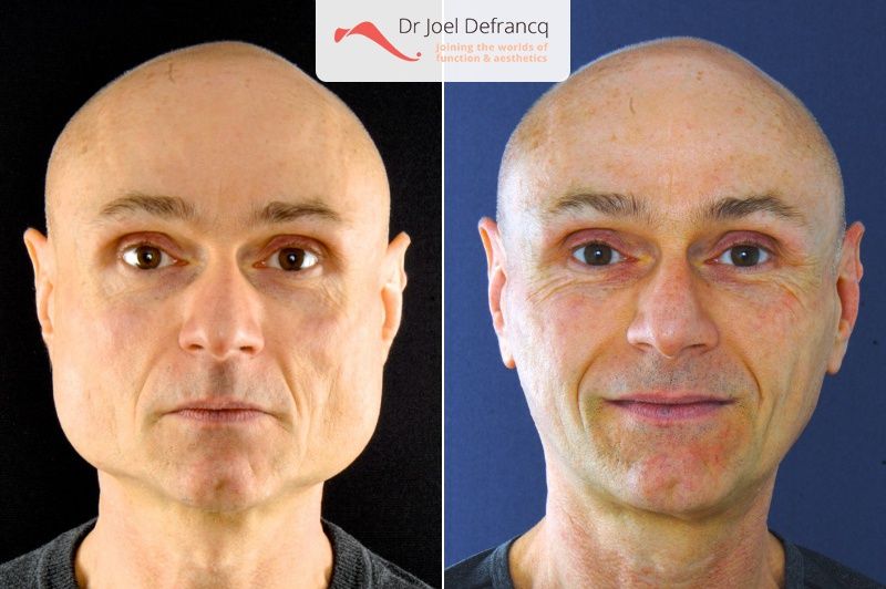 Dr Joel Defrancq 1556132974037049900 6739