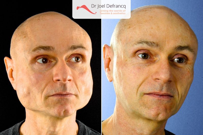 Dr Joel Defrancq 1556134967036543300 2240