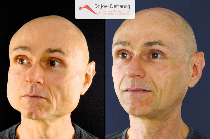 Dr Joel Defrancq 1556133044037729200 9428
