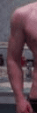 Arm