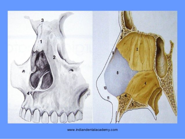 Rhinoplasty 2 certified fixed orthodontic courses by indian dental academy 21 638