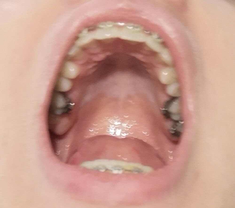 IMG 20200414 001903