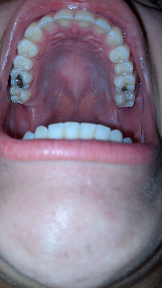 IMG 20200303 212115
