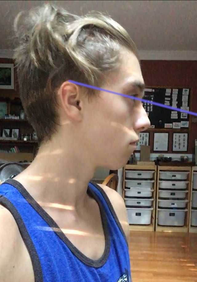 Mewingfraud1