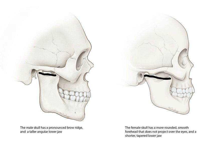1 2 Skull comparison lateral preview 850x5892