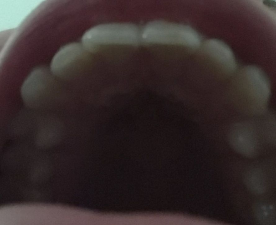 F9BD9FB6 8EC2 44CE A578 B56932AADAD2