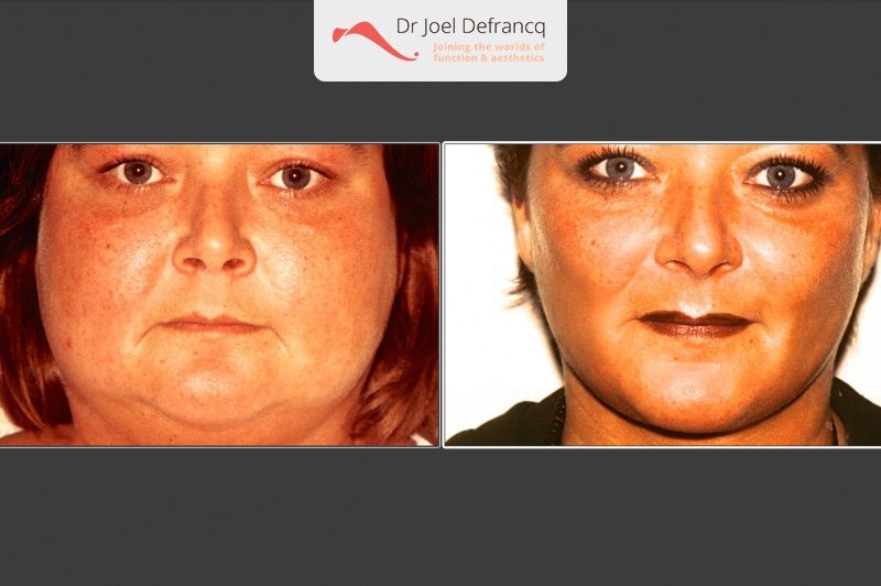 Dr Joel Defrancq 1497190535033771700 4913