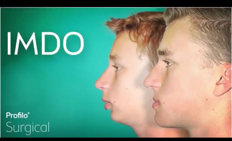 27A31F0D 645A 4EA5 92EF F81E4F7078DD