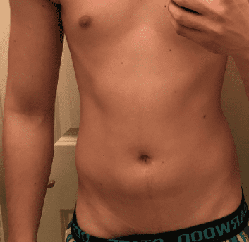 Me4