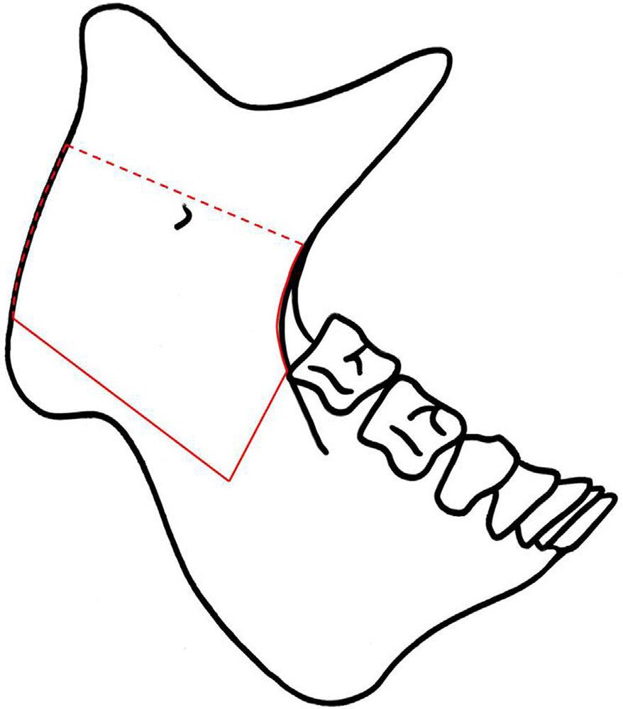 AB578C2E 5B57 490B 8AF6 263EC5E88341